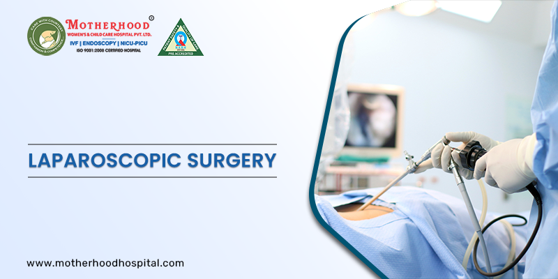 All You Need to Know about Laparoscopic Surgery